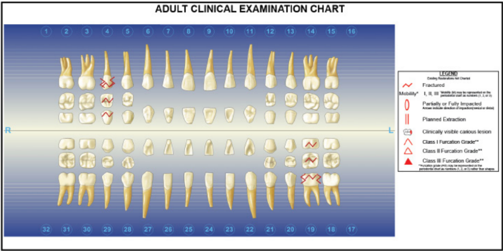 In the INBDE exam, there are questions in the form of a Dental Charts